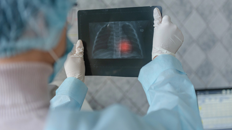 Туберкулёз: невидимый враг в аудиториях Астаны и Алматы