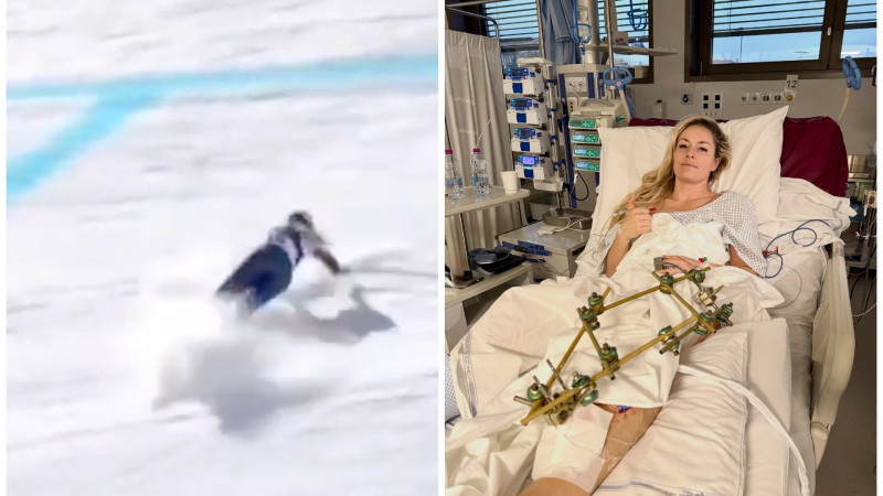 Линдси Вонн: Третья операция после жуткого падения на Олимпийских играх